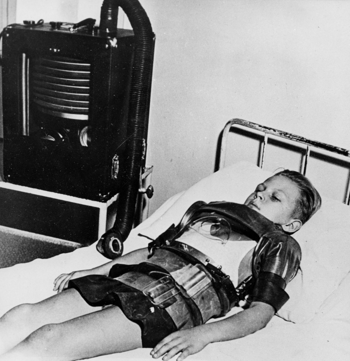 鉄肺の11歳の少年、ボージョン病院、パリ、c1947-1951 作： 不明
