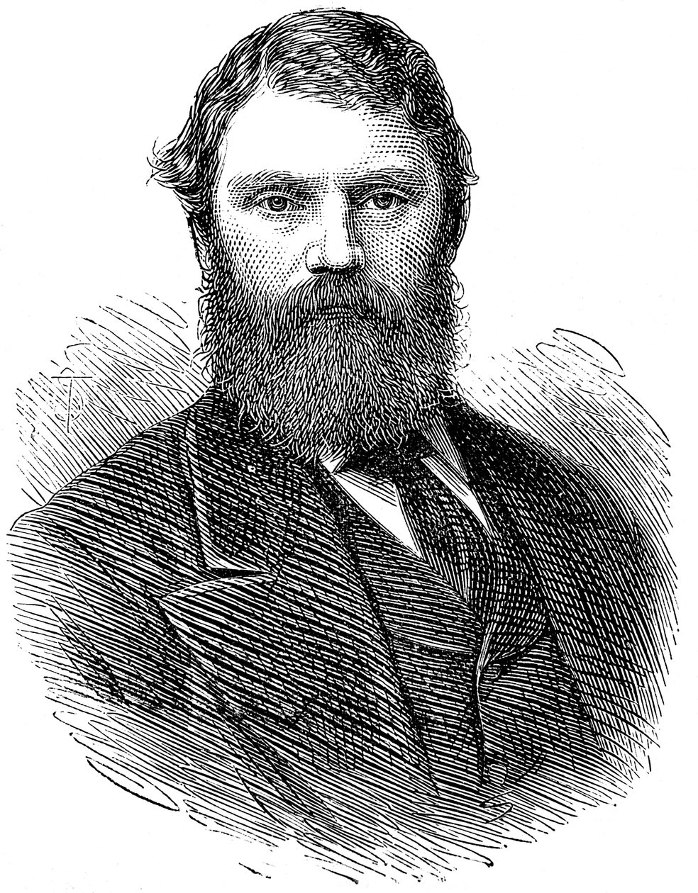 フランシスエドマンドアンスティ1833-1874、イギリスの医師、1874年 作： 不明
