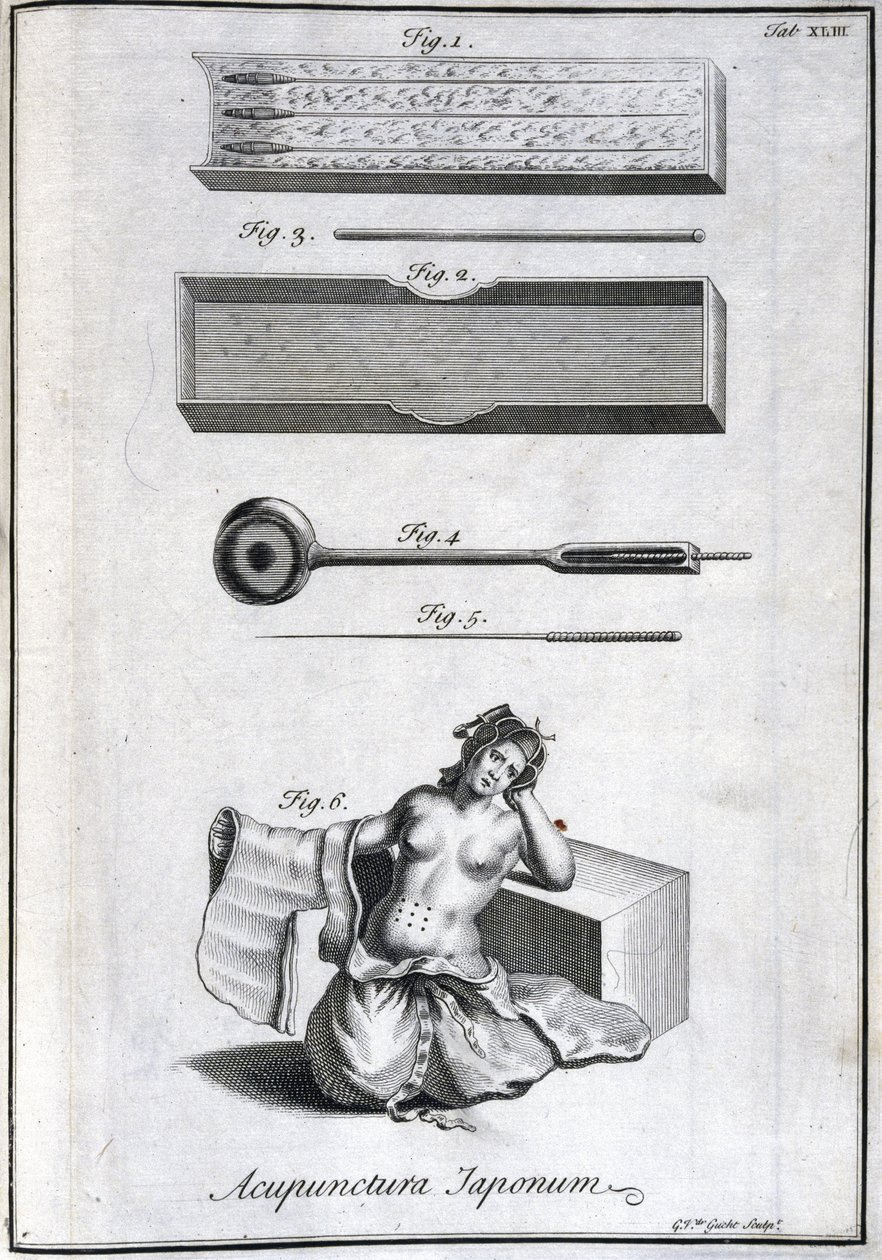 Medecine alternative : planche representant les aiguilles d