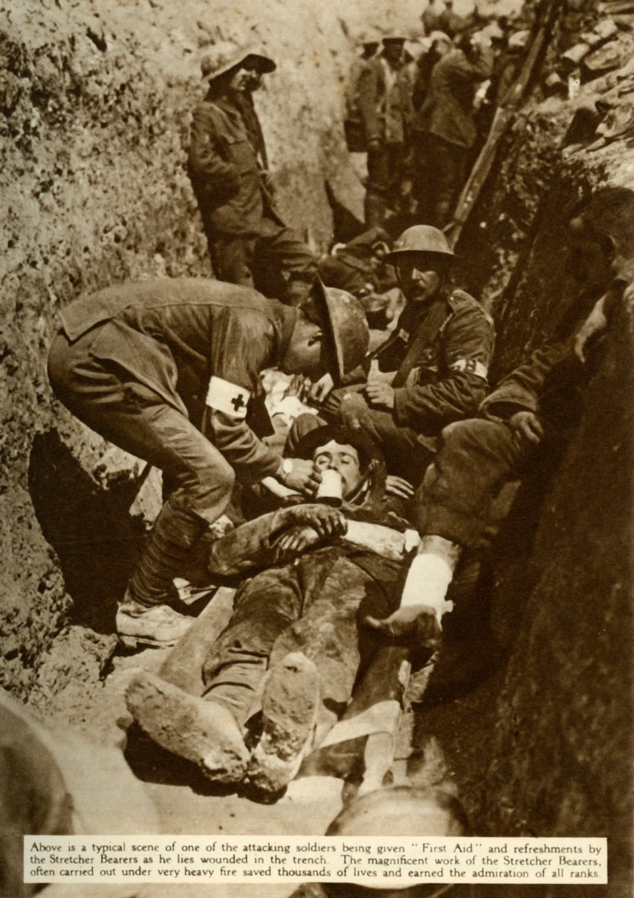 トレンチで扱われている負傷した兵士、ソンムの戦い、第一次世界大戦、1916年、1935年。 作： 不明