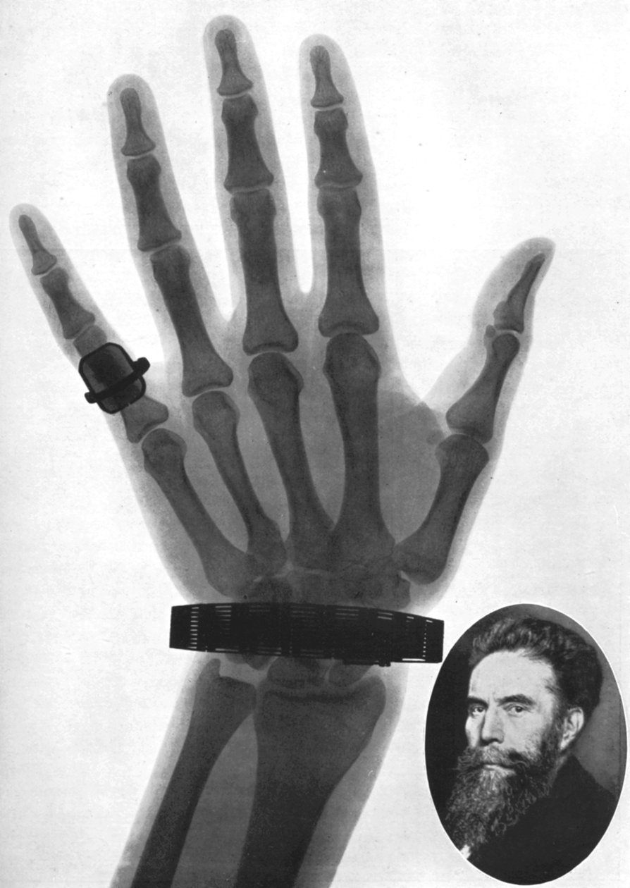 手のX線写真、1926 作： 不明