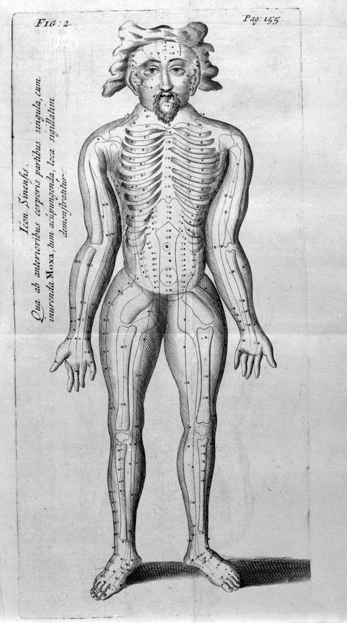 De Acupunctura by W.Ten Rhijne.ロンドン1683年。鍼灸を扱った最初の西洋文献。 作： 無名の画家