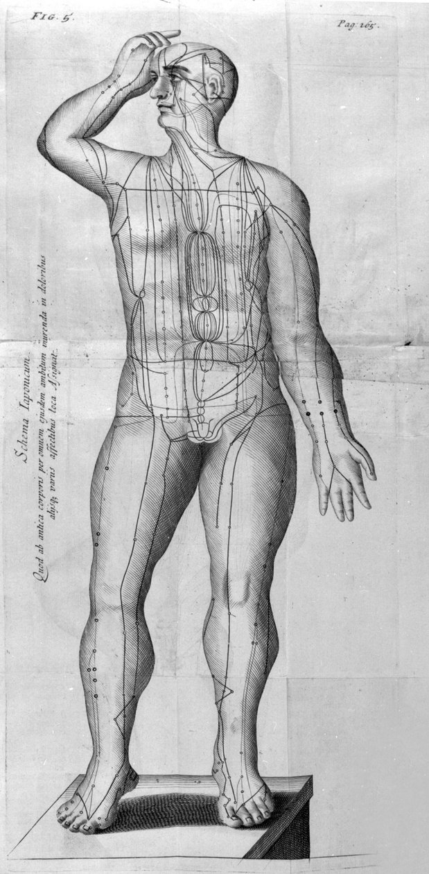 De Acupunctura by W.Ten Rhijne.ロンドン1683年。鍼灸を扱った最初の西洋文献。 作： 無名の画家
