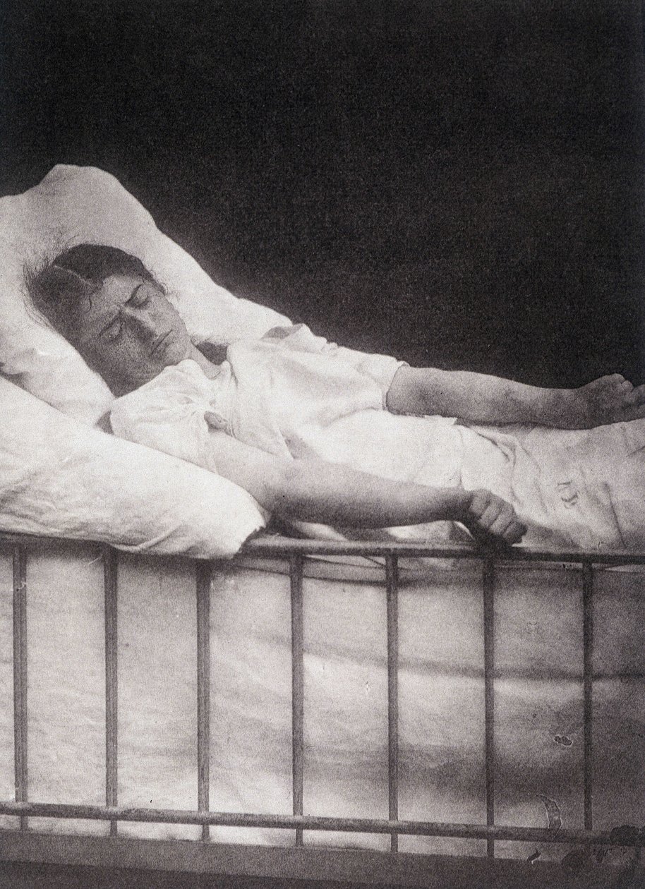 Hystero Epilepsie - Paul Regnard and Bournevilleによる "Photographic iconography of Salpétrière: service of Mr Charcot "での破傷風の発作 作： 無名の画家