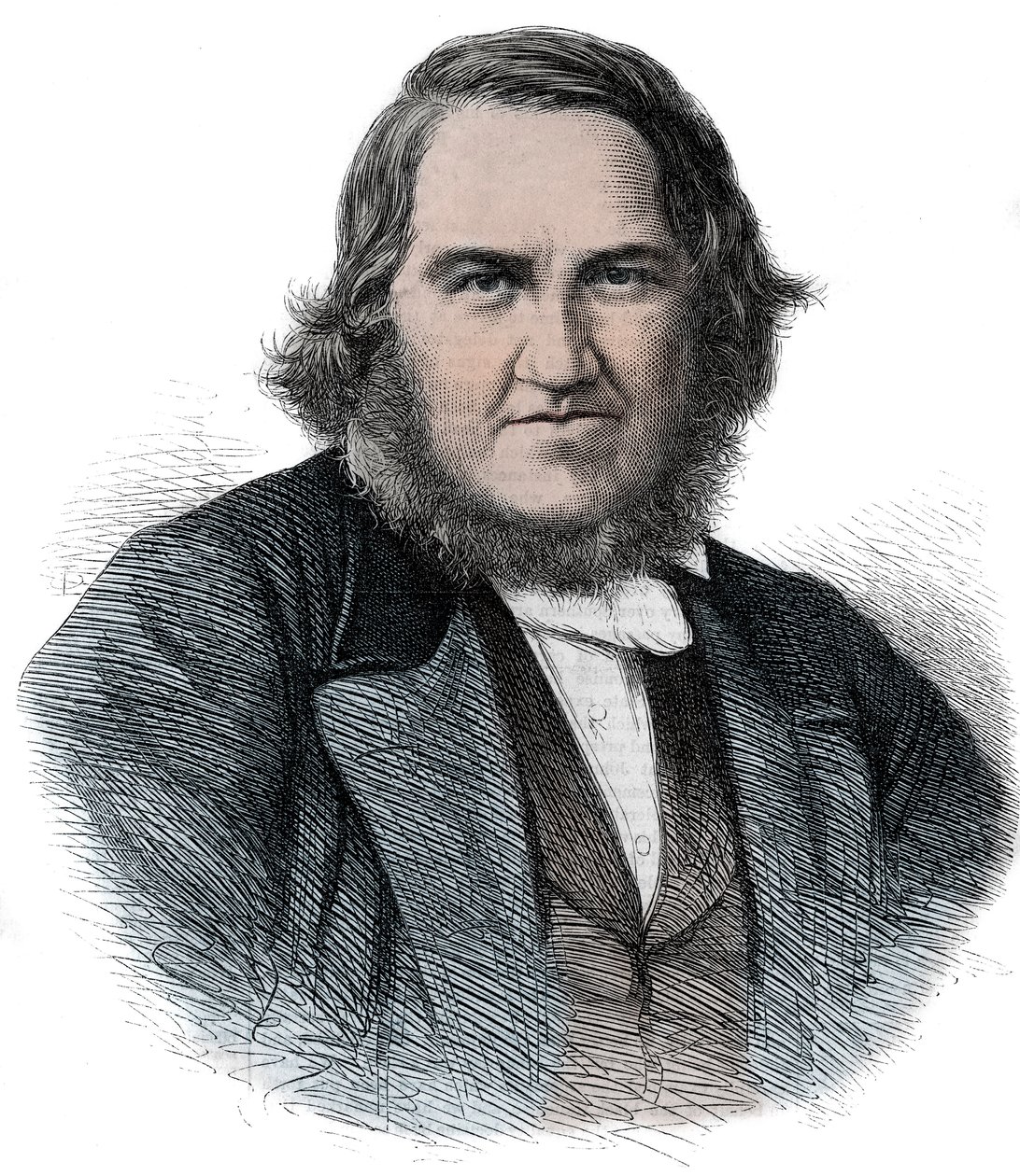 ジェームズ・ヤング・シンプソン（1811-1870）の肖像 スコットランドの産科医 - Sir James Young Simpson 作： 無名の画家