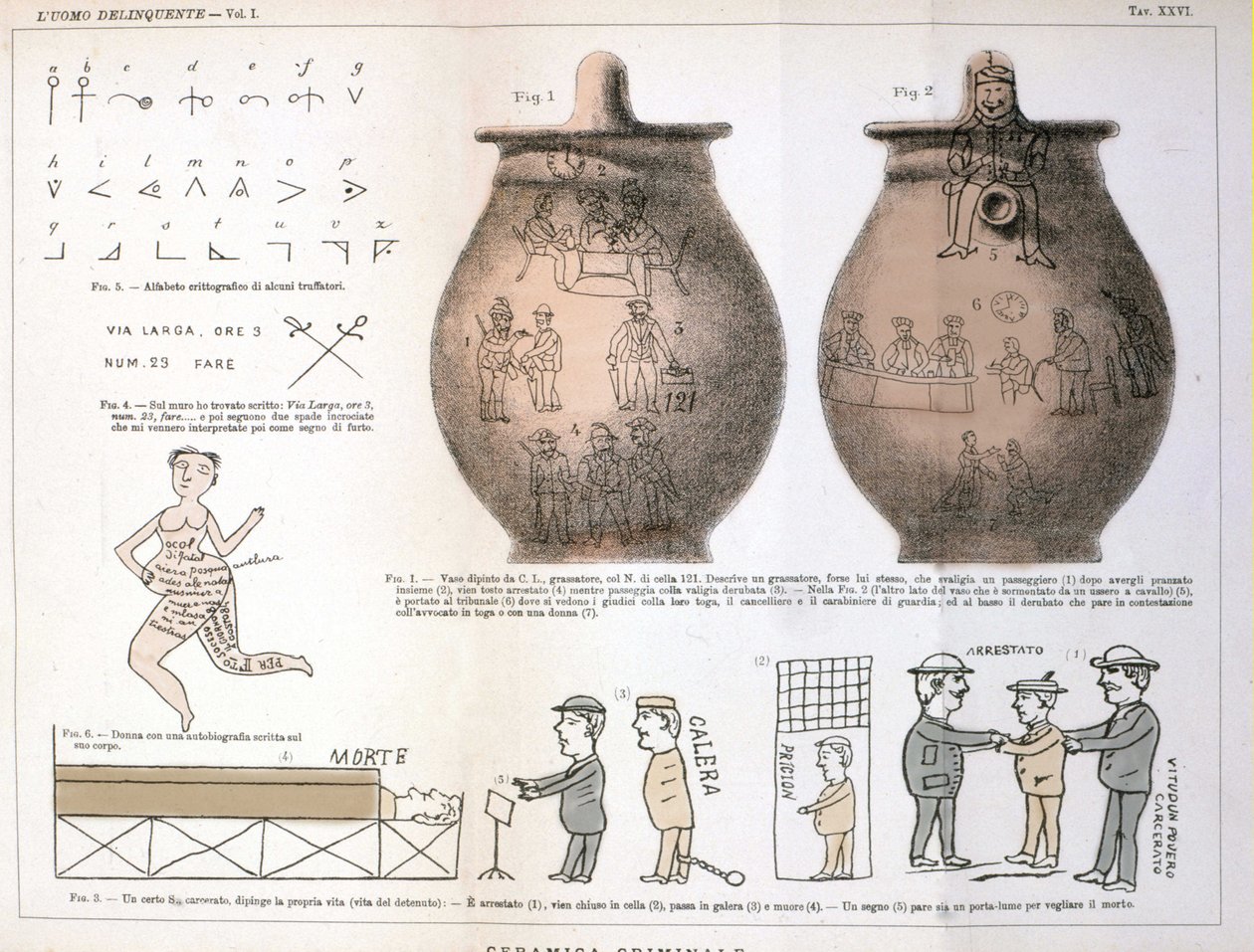 イタリアの犯罪学者チェーザレ・ロンブローゾ（1835-1909）が研究した「犯罪者」（L