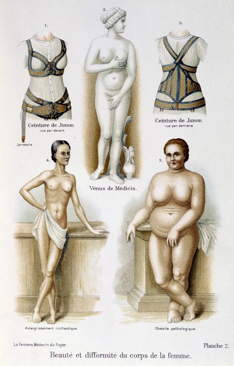 女性の体の美しさと奇形（痩せ型と肥満）；ジュノのベルト-"The woman, home doctor "にて 作： 無名の画家