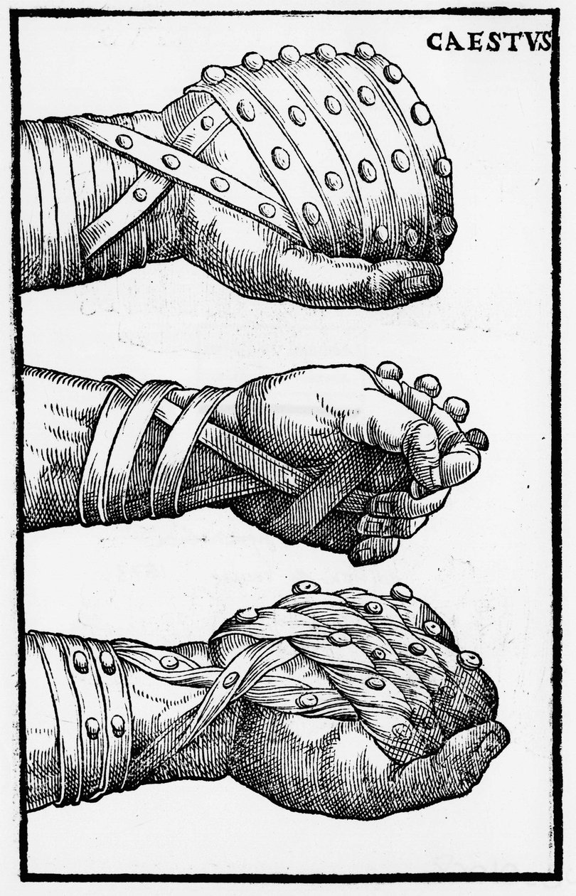 ボクシンググローブ - 「Hieronymi Mercurialis de Arte Gymnastica」ヴェネツィア版にて 作： 無名の画家