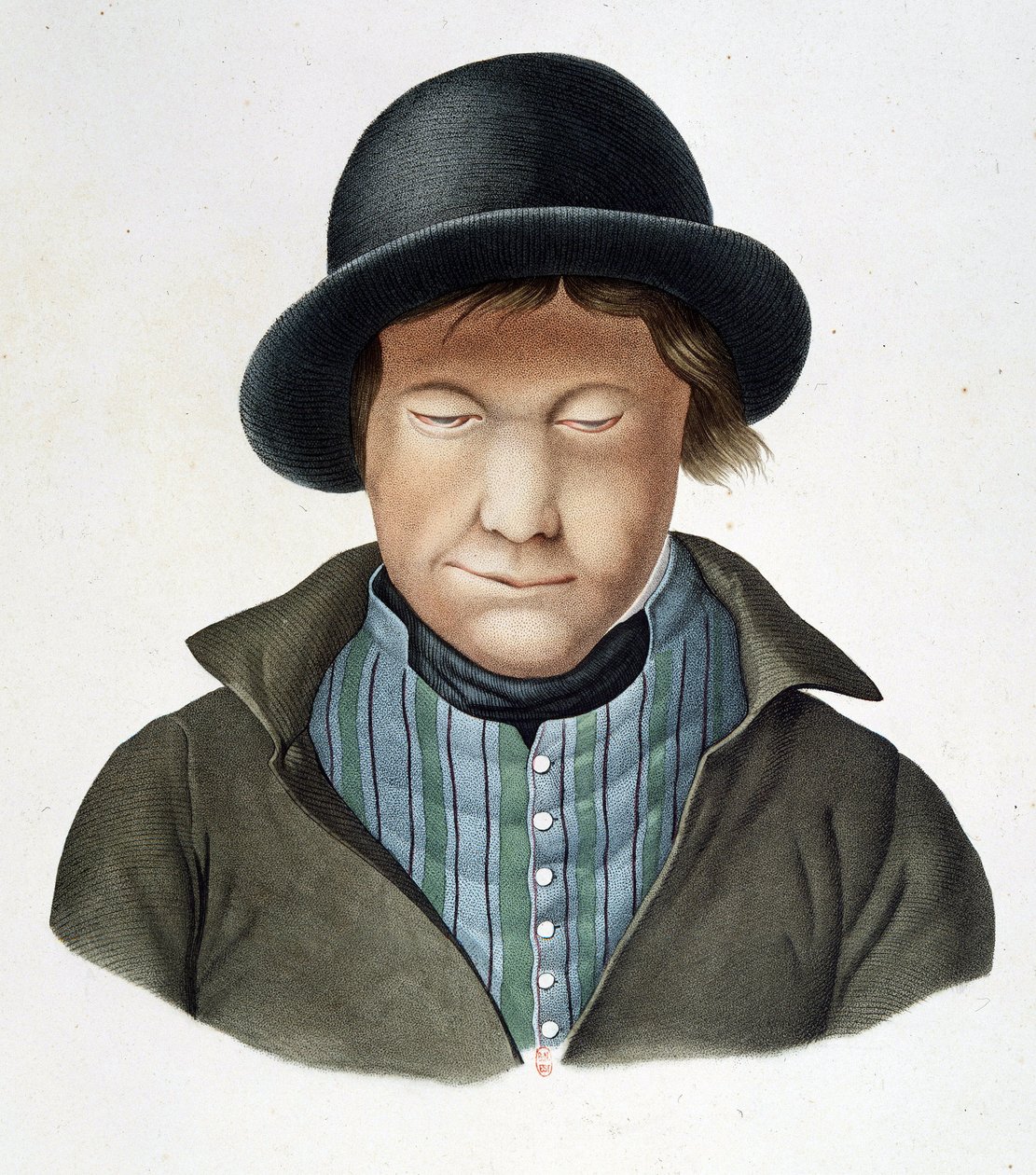 アイスランドのLepers、1840年頃、B.N. 作： 無名の画家