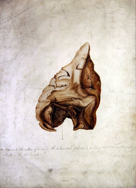 脳の習作 I, c.1850 （水彩・紙） 作： ウィリアム・ラヴァー