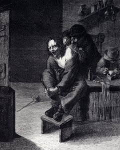 外科手術 アドリアン・ブラウワー（1608年生まれ）の絵画に基づくエングレービング 17世紀 作： Adriaen (after) Brouwer