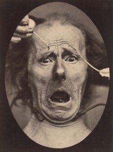Electro-Physiology、Figure 64、1854-56、1862 年に印刷。 作： Adrien Alban Tournachon