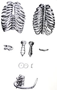 De Humani Corporis Fabricaの最初の本のプレート 作： Andreas Vesalius