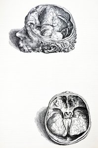 De Humani Corporis Fabricaの7番目の本のプレート 作： Andreas Vesalius