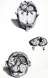 De Humani Corporis Fabricaの7番目の本のプレート 作： Andreas Vesalius