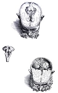 De Humani Corporis Fabricaの7番目の本のプレート 作： Andreas Vesalius