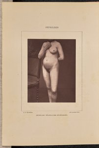 汎発性小水疱性梅毒 作： Arthur de Montmeja