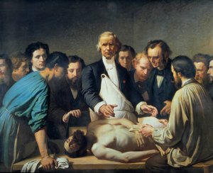 アルフレッド・ヴェロー医師（1795-1867）がチャリティーで解剖を進める 死体に介入する準備をしている学生たちに囲まれた医師。フランソワ・フェイアン・ペラン（1826-1888）の絵画。19世紀。トゥール美術館 - アルフレッド・ヴェルポー 作： Auguste (after) Feyen Perrin