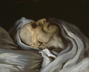 死の床でのテオドール・ジェリコー 作： Charles Emile Callande de Champmartin