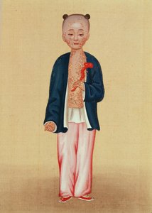 天然痘の子供（紙にトイレ） 作： Chinese School