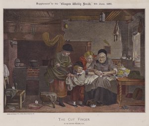 The Cut Finger（カラーリトグラフ