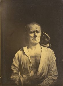 mの痙攣。 左の非常に強い光の下でのコルゲーター・スーパーシリイ、リラックスした顔...、1854-1855。 作： Duchenne de Boulogne