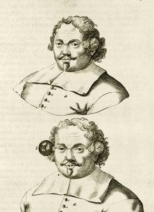 カッピングの例、実践的な演習からフレデリックデッカーズによる治癒法まで、1694年 作： Dutch School