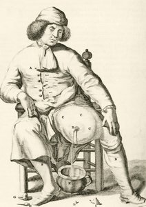 膿瘍からの液体の排出、Frederic Dekkersによる実践的な練習から治癒方法、1694年