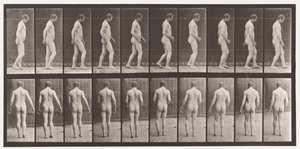 プレート553.頭の外傷後;ウォーキング、1885 作： Eadweard Muybridge
