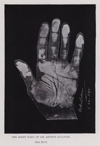 アーサー・サリバン卿の右手（モノクロ写真 作： English Photographer
