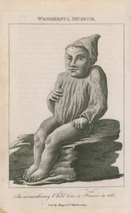 1683年にフランスで生まれた並外れた子供 作： English School