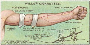 止血帯、Wills Cigarettesカードの応急処置シリーズのno.11、1913 作： English School