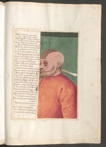  作： エーリッヒ・レッシング