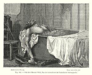 外科麻酔の発明者の一人であるホレス・ウエルスの自殺（エングレービング 作： European School