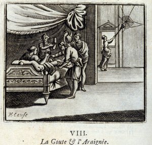 痛風と荒れ狂う人ジャン・ド・ラ・フォンテーヌ（1621-95）の寓話。挿絵はフランソワ・ショーボー（1613-1676）。1728年の版。 作： Francois Chauveau