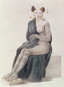 先天性魚鱗癬、GMオルバースの本、1830年 作： French School