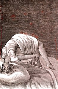 ヒステリー、強い不安から起こる精神・神経障害。1887年（エングレーヴィング） 作： French School