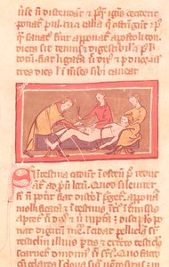 Ms H 89 fol.23手術、Rogier de Salerne著 『Book of Surgery』から 作： French School