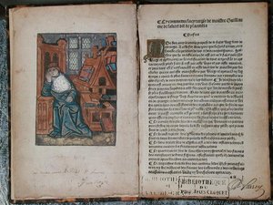 パリの「La Cyrurgie de Maistre Guillaume de Salicet」のページ。 作： French School