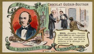ポール・ブローカ（フランスの医師、解剖学者、人類学者）（クロモリト 作： French School