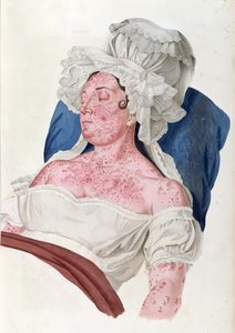 ショパール、1833年に刻まれたジャンルイアリベール男爵（1768年から1837年）の本からの、緋色の熱を持つ女性