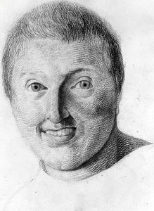 ガブリエルが描いた「異人の人相学の研究」に登場するてんかん患者。 作： Georges Francois Gabriel