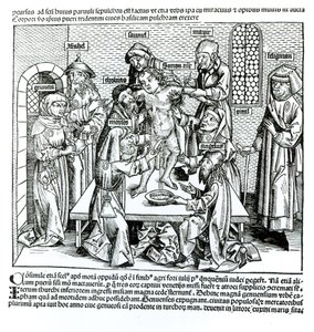 割礼、Hartmann Schedel（1440-1514）による「Liber Chronicarum」より 作： German School