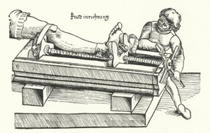 怪我をした脚をまっすぐにする装置（彫刻 作： German School