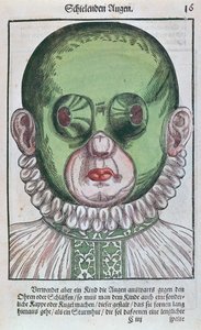 眼帯を治療するためのマスク。眼科治療用のマスクで、1583年にドレスデンで出版されたGeorg Bartisch（1535-1636）によるOcolourmodouleia（色の木版画） 作： German School