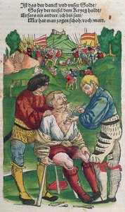 矢印を削除、ハンスフォンゲルスドルフ作「フェルトブッフデアヴンダルツニー」、1540年 作： German School