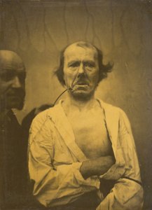リラックスした表情（左）。 嫌悪（右） 作： Guillaume Benjamin Amant Duchenne