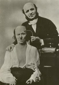 老人に電気生理装置を使うフランスの神経学者デュシェンヌ・ドゥ・ブローニュ 作： Guillaume Benjamin Armand Duchenne de Boulogne