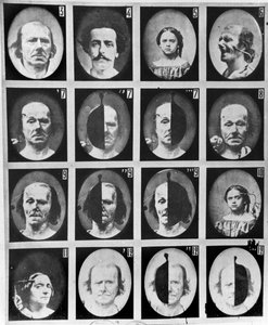 1876年パリ発行のDuchenne de Boulogneによる「Mechanisme de la Physionomie humaine ou analyze electrophysiologique des passions」からの生理学的研究 作： Guillaume Benjamin Armand Duchenne de Boulogne
