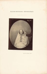 写真電気生理学、図76 作： Guillaume Benjamin Duchenne